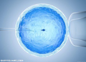 液氮存储